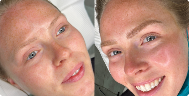 b&a-img1