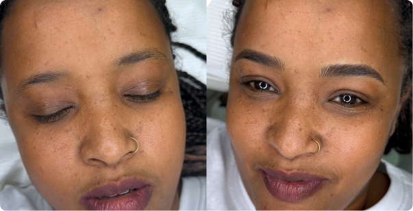 b&a-img2