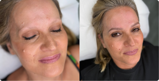 b&a-img3